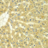 Immunohistochemistry - Anti-ADCK3 Antibody (A7378) - Antibodies.com