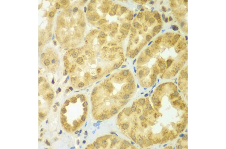 Immunohistochemistry - Anti-ADCK3 Antibody (A7378) - Antibodies.com