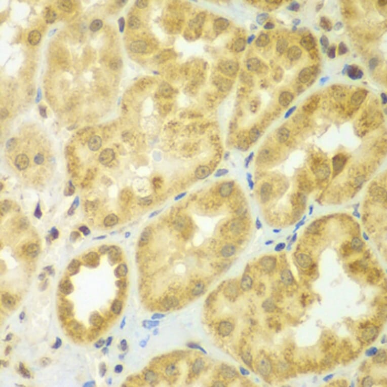Immunohistochemistry - Anti-ADCK3 Antibody (A7378) - Antibodies.com