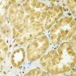 Immunohistochemistry - Anti-ADCK3 Antibody (A7378) - Antibodies.com