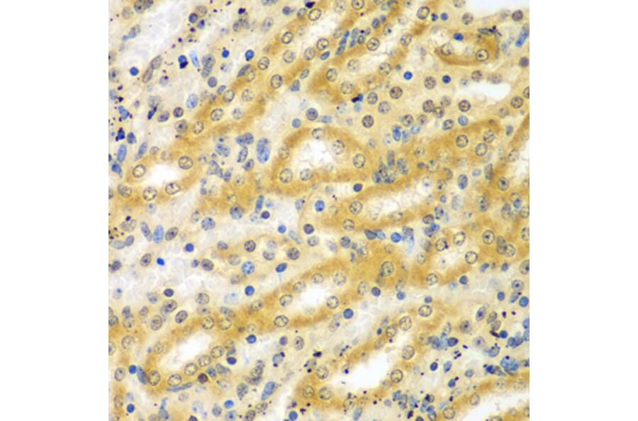 Immunohistochemistry - Anti-ADCK3 Antibody (A7378) - Antibodies.com