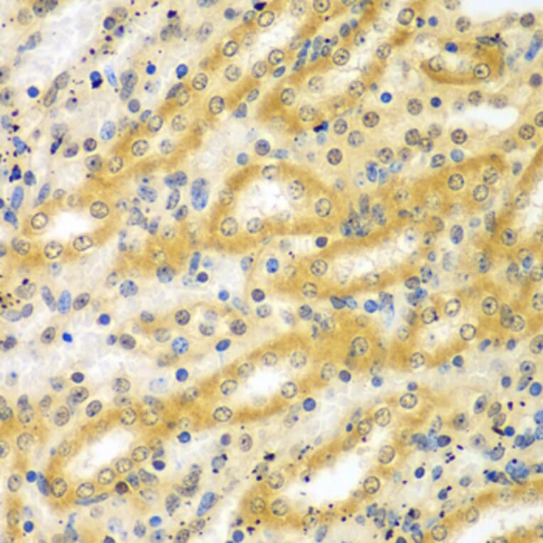 Immunohistochemistry - Anti-ADCK3 Antibody (A7378) - Antibodies.com