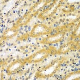 Immunohistochemistry - Anti-ADCK3 Antibody (A7378) - Antibodies.com