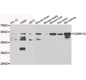 Western Blot - Anti-CAMK1G Antibody (A7379) - Antibodies.com