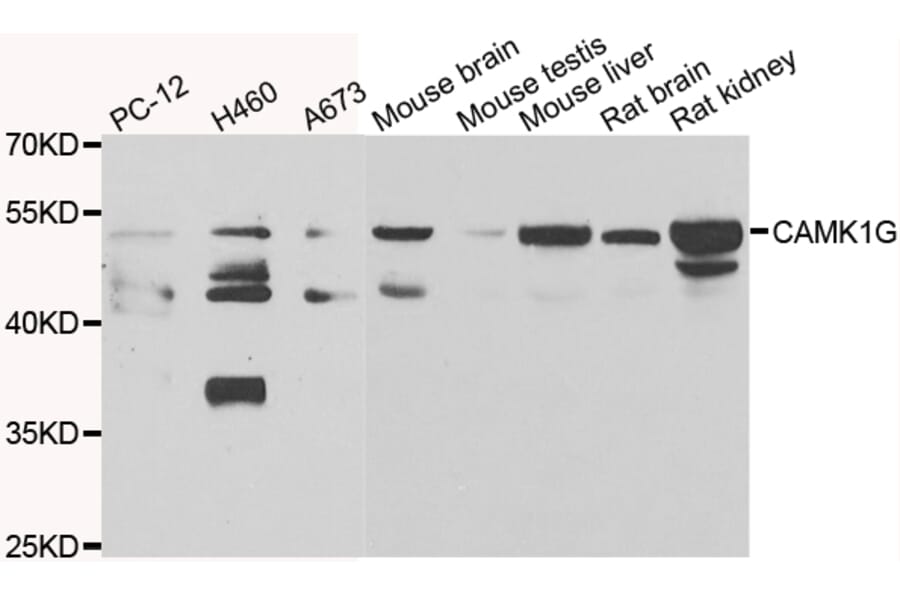 Western Blot - Anti-CAMK1G Antibody (A7379) - Antibodies.com