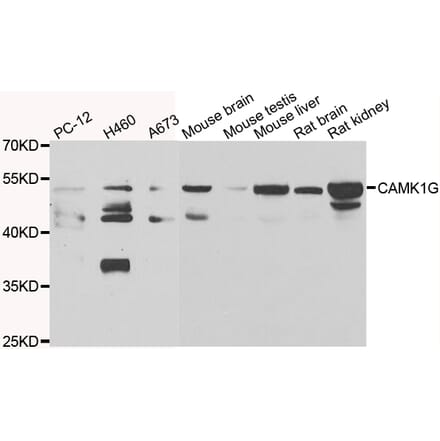 Western Blot - Anti-CAMK1G Antibody (A7379) - Antibodies.com