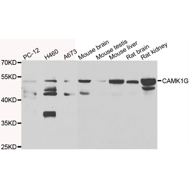 Western Blot - Anti-CAMK1G Antibody (A7379) - Antibodies.com
