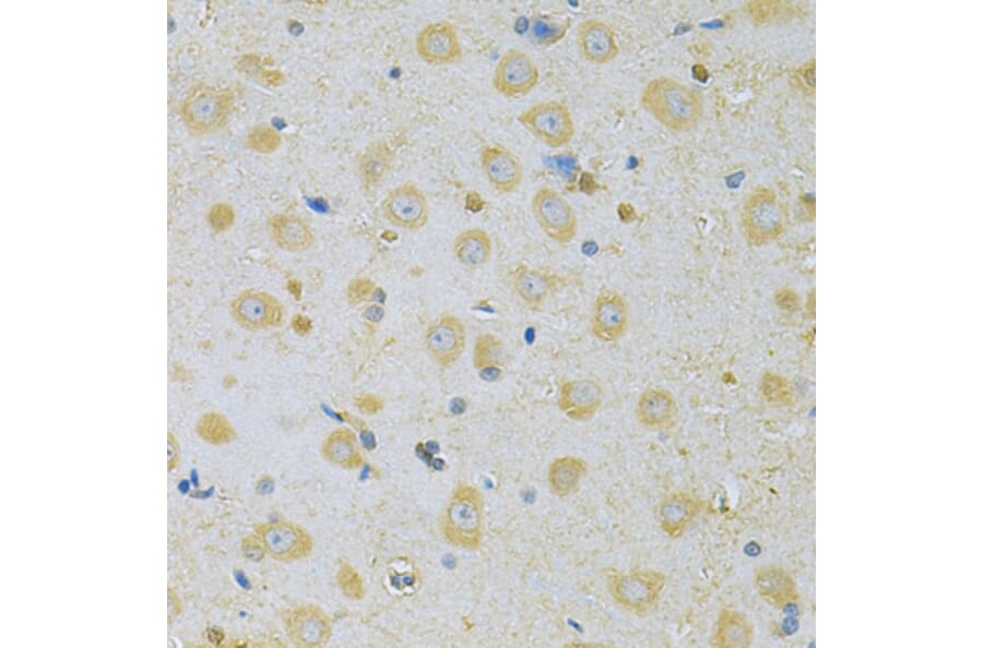 Immunohistochemistry - Anti-CAMK1G Antibody (A7379) - Antibodies.com