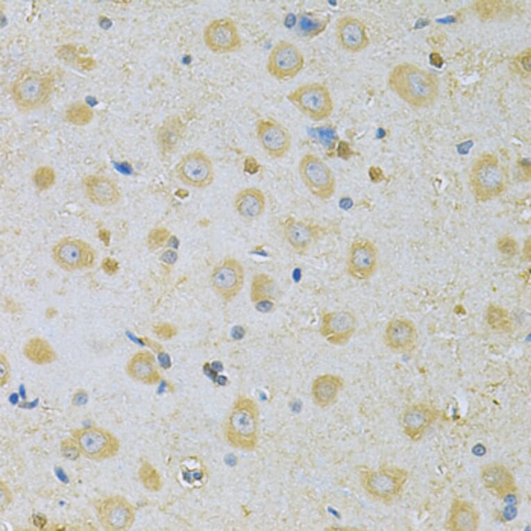 Immunohistochemistry - Anti-CAMK1G Antibody (A7379) - Antibodies.com