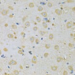 Immunohistochemistry - Anti-CAMK1G Antibody (A7379) - Antibodies.com