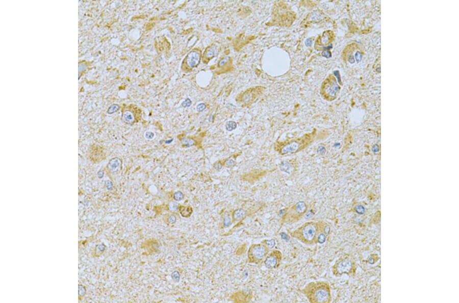 Immunohistochemistry - Anti-CAMK1G Antibody (A7379) - Antibodies.com