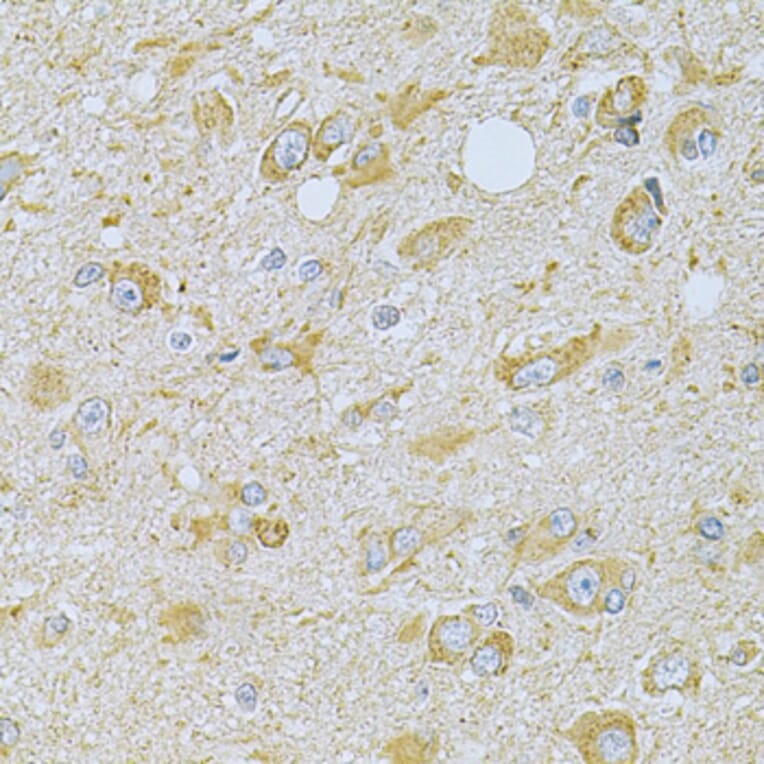 Immunohistochemistry - Anti-CAMK1G Antibody (A7379) - Antibodies.com
