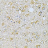 Immunohistochemistry - Anti-CAMK1G Antibody (A7379) - Antibodies.com