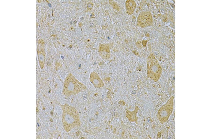 Immunohistochemistry - Anti-CAMK1G Antibody (A7379) - Antibodies.com