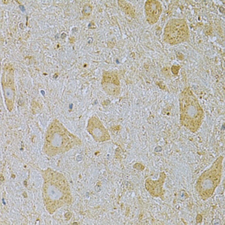 Immunohistochemistry - Anti-CAMK1G Antibody (A7379) - Antibodies.com