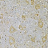 Immunohistochemistry - Anti-CAMK1G Antibody (A7379) - Antibodies.com