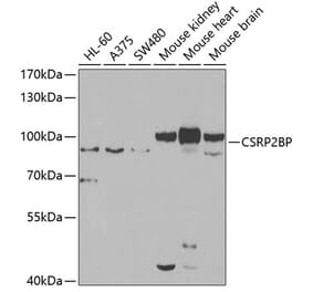Western Blot - Anti-CSRP2BP Antibody (A15672) - Antibodies.com