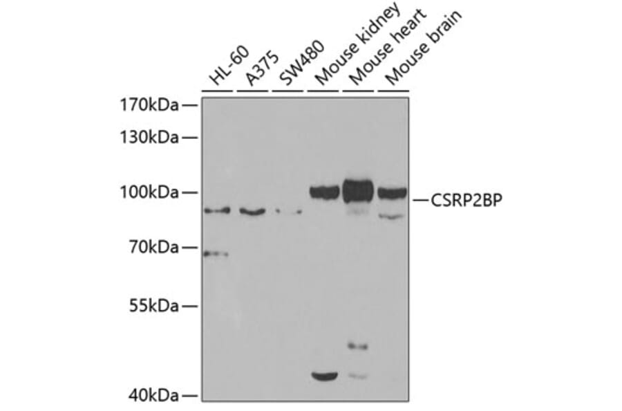 Western Blot - Anti-CSRP2BP Antibody (A15672) - Antibodies.com