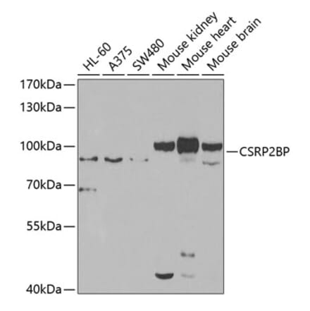 Western Blot - Anti-CSRP2BP Antibody (A15672) - Antibodies.com