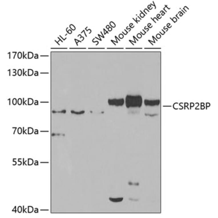 Western Blot - Anti-CSRP2BP Antibody (A15672) - Antibodies.com