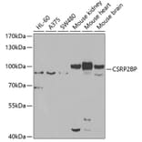 Western Blot - Anti-CSRP2BP Antibody (A15672) - Antibodies.com