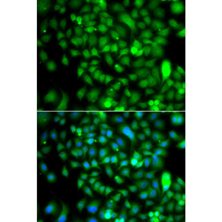 Immunofluorescence - Anti-CSRP2BP Antibody (A15672) - Antibodies.com