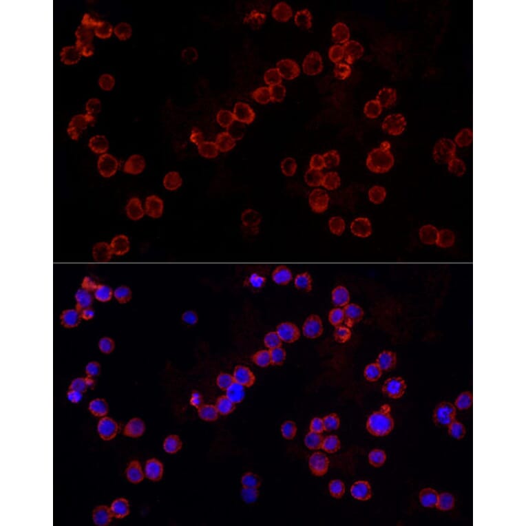 Immunofluorescence - Anti-NLRC4 Antibody (A15673) - Antibodies.com