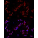 Immunofluorescence - Anti-NLRC4 Antibody (A15673) - Antibodies.com