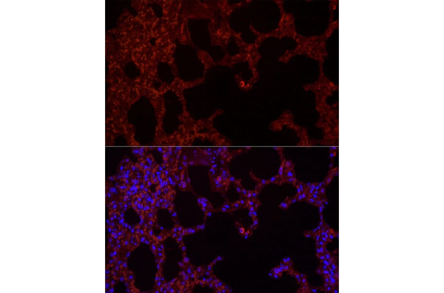 Immunofluorescence - Anti-NLRC4 Antibody (A15673) - Antibodies.com