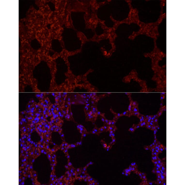 Immunofluorescence - Anti-NLRC4 Antibody (A15673) - Antibodies.com