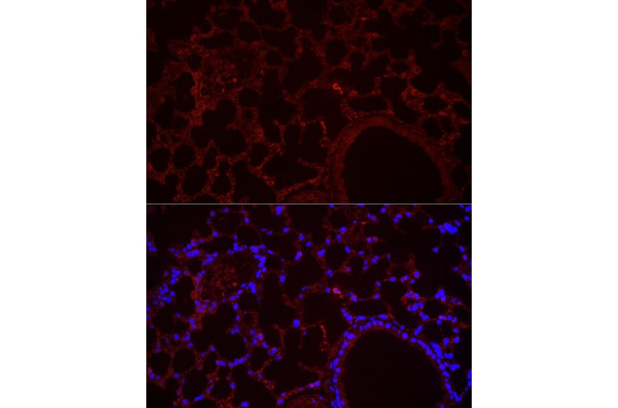 Immunofluorescence - Anti-NLRC4 Antibody (A15673) - Antibodies.com