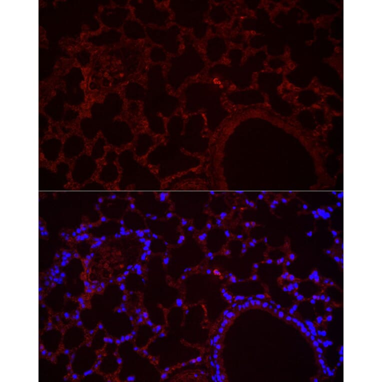 Immunofluorescence - Anti-NLRC4 Antibody (A15673) - Antibodies.com