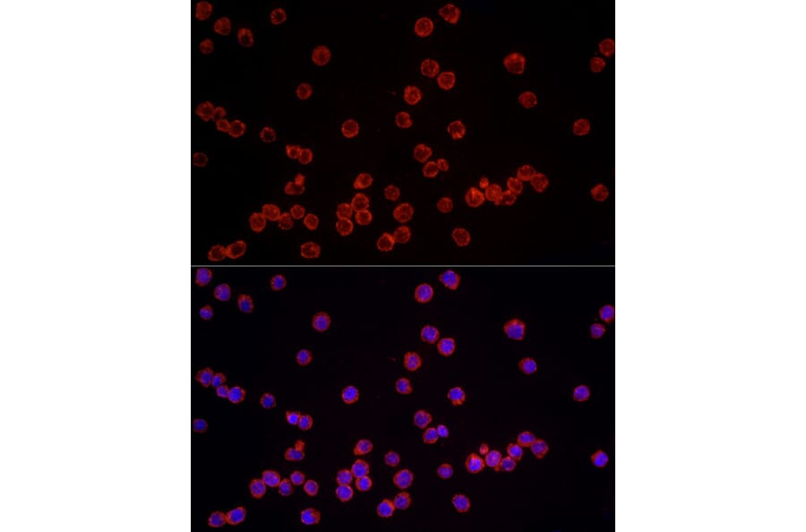 Immunofluorescence - Anti-NLRC4 Antibody (A15673) - Antibodies.com