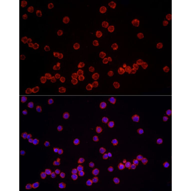 Immunofluorescence - Anti-NLRC4 Antibody (A15673) - Antibodies.com