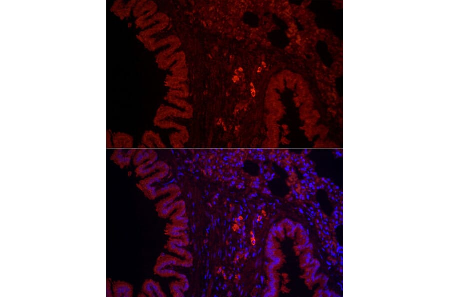 Immunofluorescence - Anti-NLRC4 Antibody (A15673) - Antibodies.com