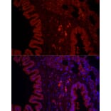 Immunofluorescence - Anti-NLRC4 Antibody (A15673) - Antibodies.com