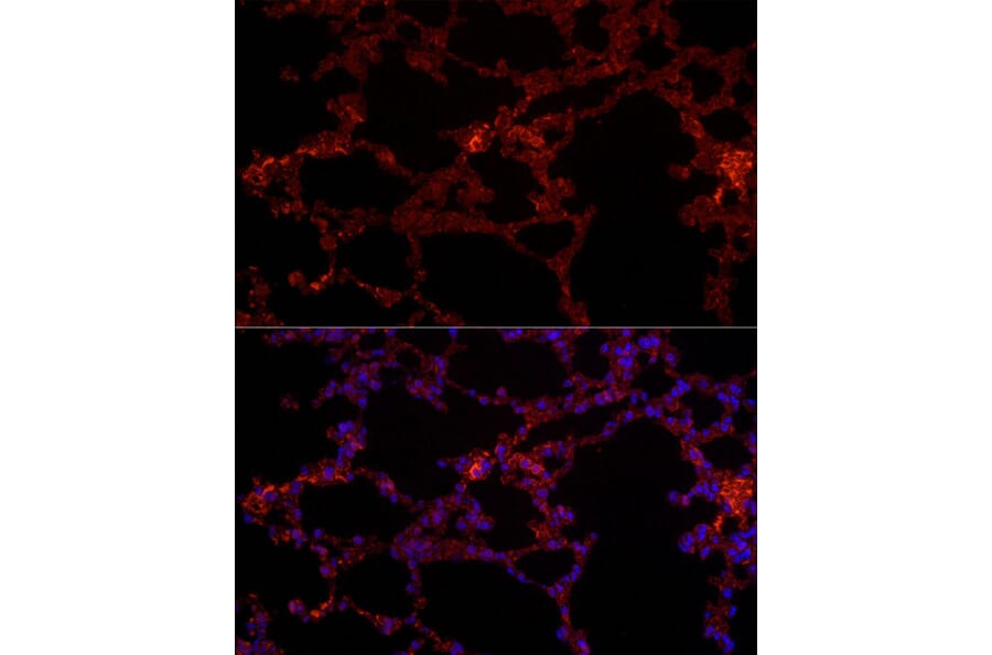 Immunofluorescence - Anti-NLRC4 Antibody (A15673) - Antibodies.com