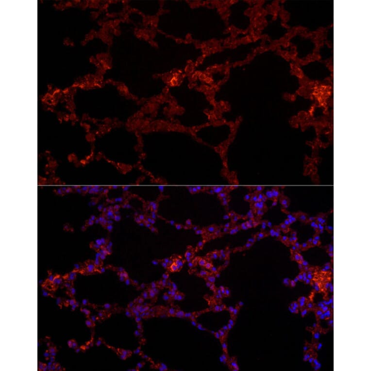 Immunofluorescence - Anti-NLRC4 Antibody (A15673) - Antibodies.com