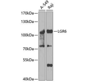 Western Blot - Anti-GPCR LGR6 Antibody (A15674) - Antibodies.com