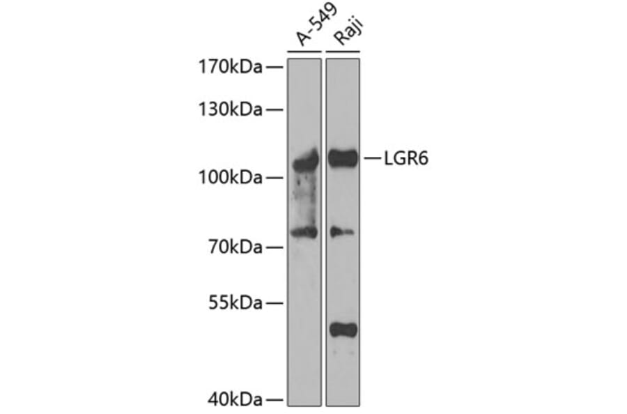 Western Blot - Anti-GPCR LGR6 Antibody (A15674) - Antibodies.com