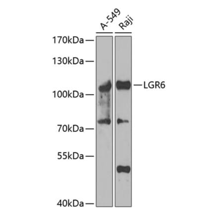 Western Blot - Anti-GPCR LGR6 Antibody (A15674) - Antibodies.com