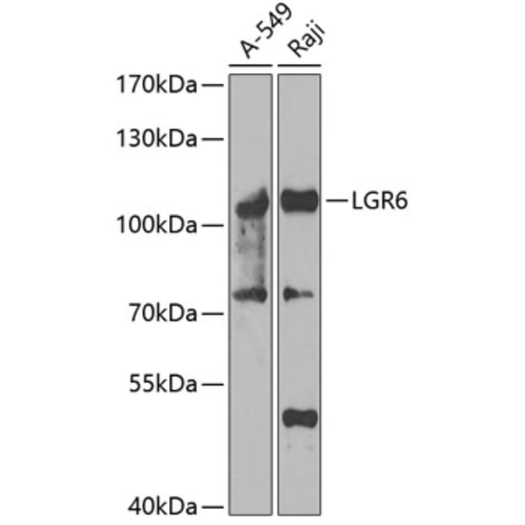 Western Blot - Anti-GPCR LGR6 Antibody (A15674) - Antibodies.com