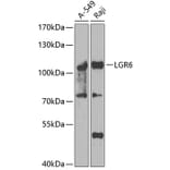 Western Blot - Anti-GPCR LGR6 Antibody (A15674) - Antibodies.com