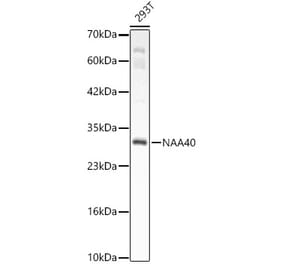 Western Blot - Anti-PATT1 Antibody (A15675) - Antibodies.com