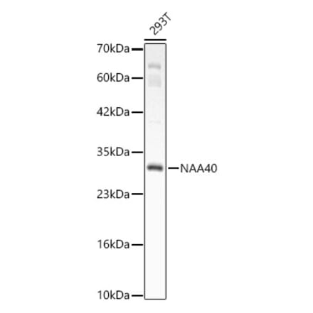 Western Blot - Anti-PATT1 Antibody (A15675) - Antibodies.com