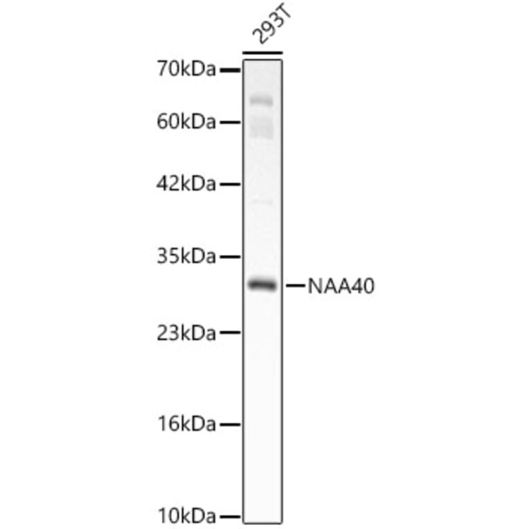 Western Blot - Anti-PATT1 Antibody (A15675) - Antibodies.com