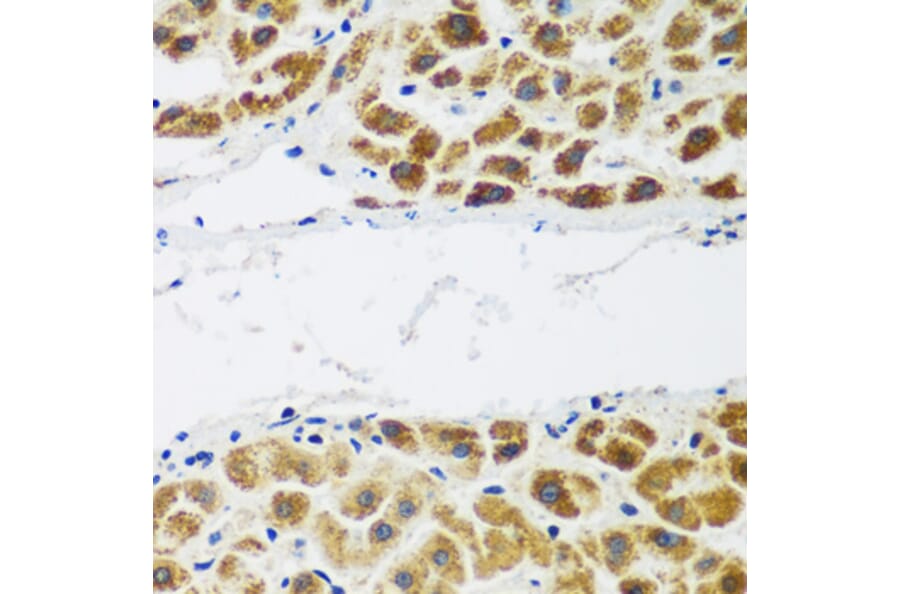 Immunohistochemistry - Anti-FLJ14154 Antibody (A15676) - Antibodies.com