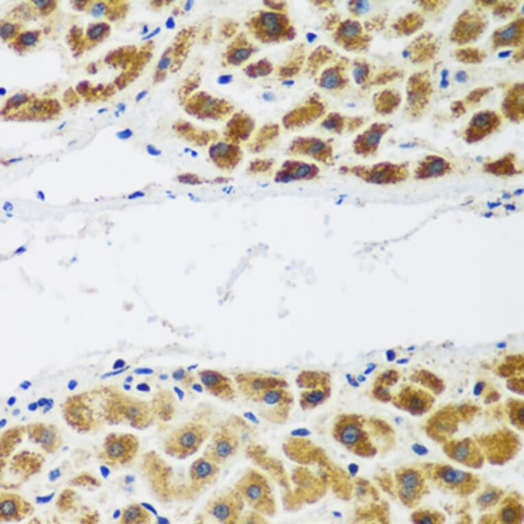 Immunohistochemistry - Anti-FLJ14154 Antibody (A15676) - Antibodies.com