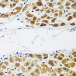 Immunohistochemistry - Anti-FLJ14154 Antibody (A15676) - Antibodies.com