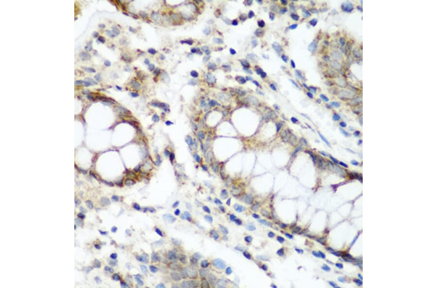 Immunohistochemistry - Anti-FLJ14154 Antibody (A15676) - Antibodies.com